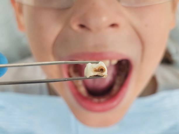 Best Dental Emergency Near Me  in Angwin, CA